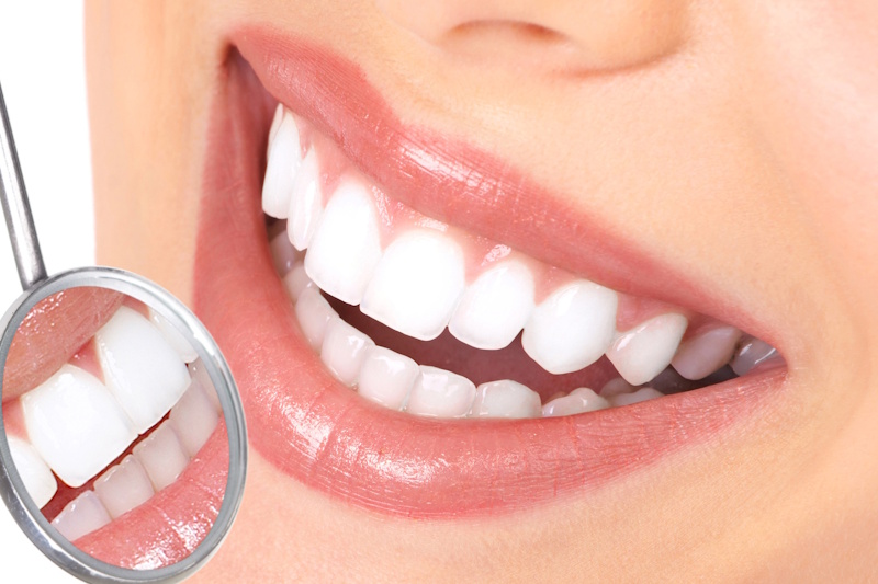estetica_dental_en_getafe