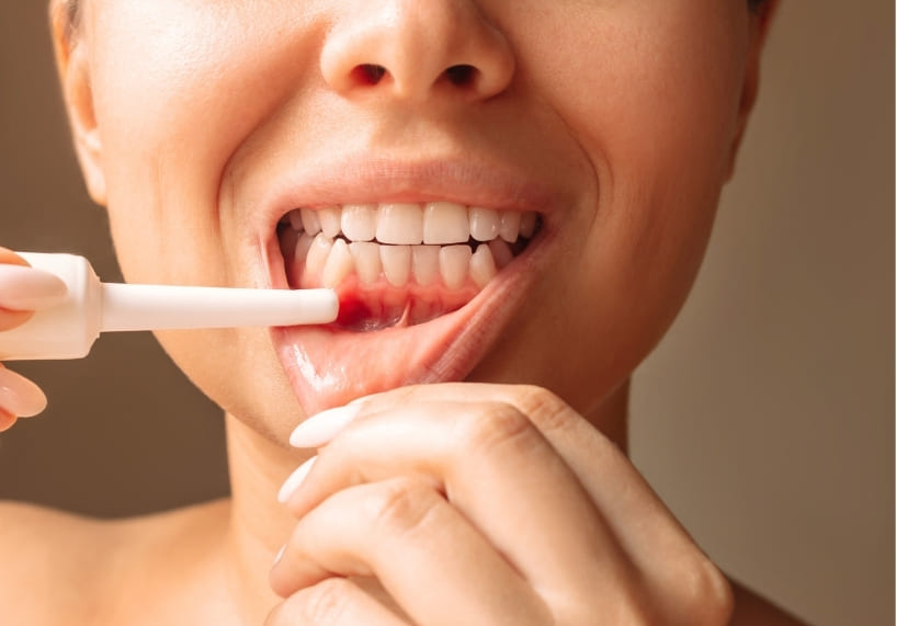 enfermedad periodontal causas sintomas y tratamiento