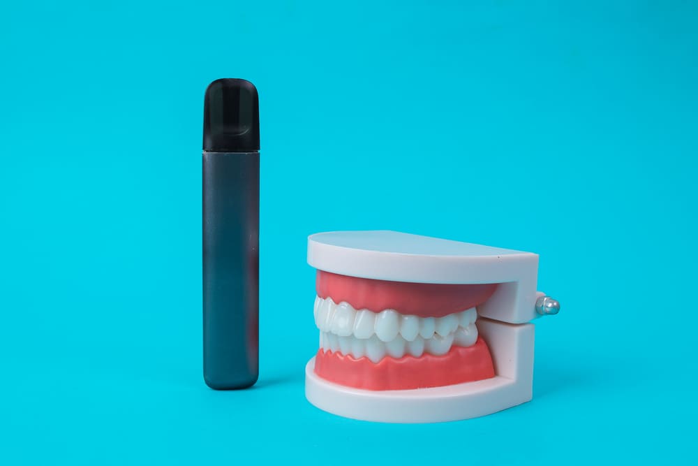 revision dental periodica en bm clinicas dentales